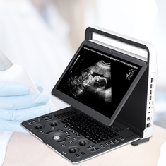 Ультразвук Машина Requipo De Ultrasonido Doppler цвета M/B/2B/4B/диагноза Sonoscape E2 Ecografo сердечный васкулярный